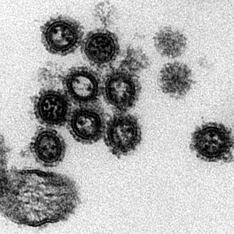 influenza-a-virus-pathology