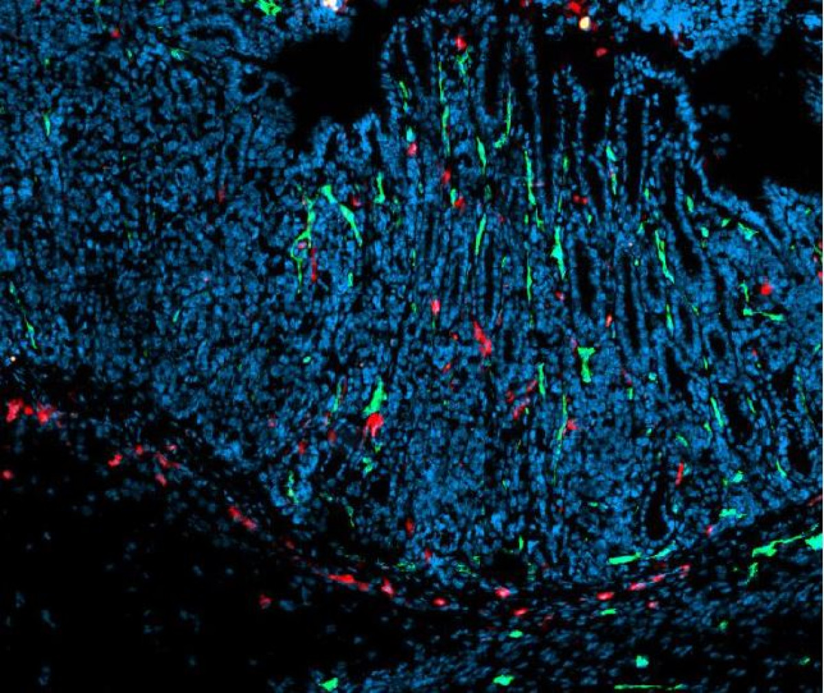 immunopharmacology-of-cancer