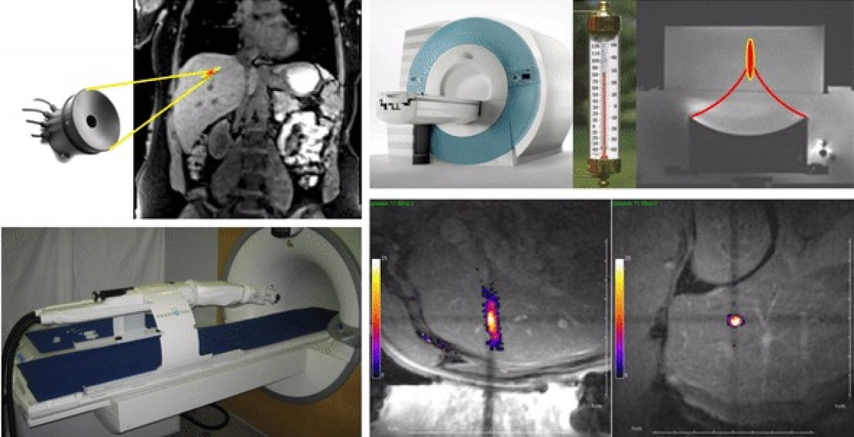 biomedical-engineering-and-interventional-imaging