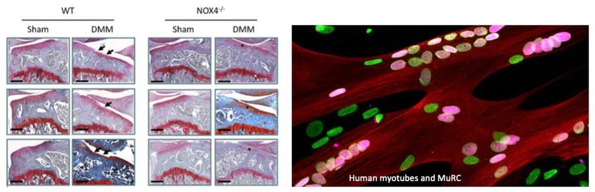 cell-therapy-musculoskeletal-disorders