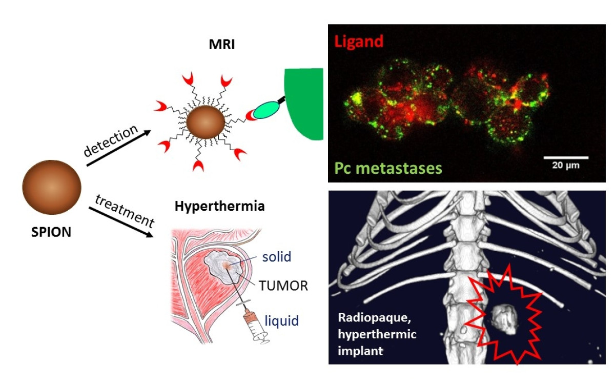 advanced-drug-delivery-carriers