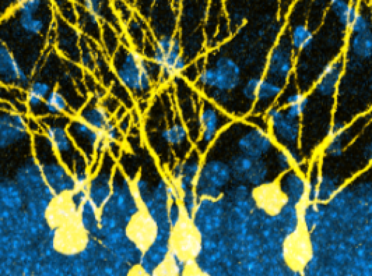 epigenetic-regulation-brain-development